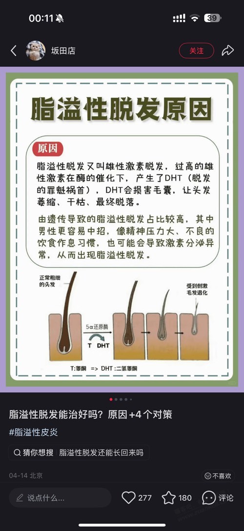 脂溢性脱发，有什么提升发量的方法？有经验的来教教