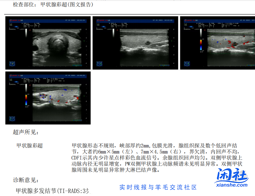 体检结论汇总 兄弟们我是不是快死了