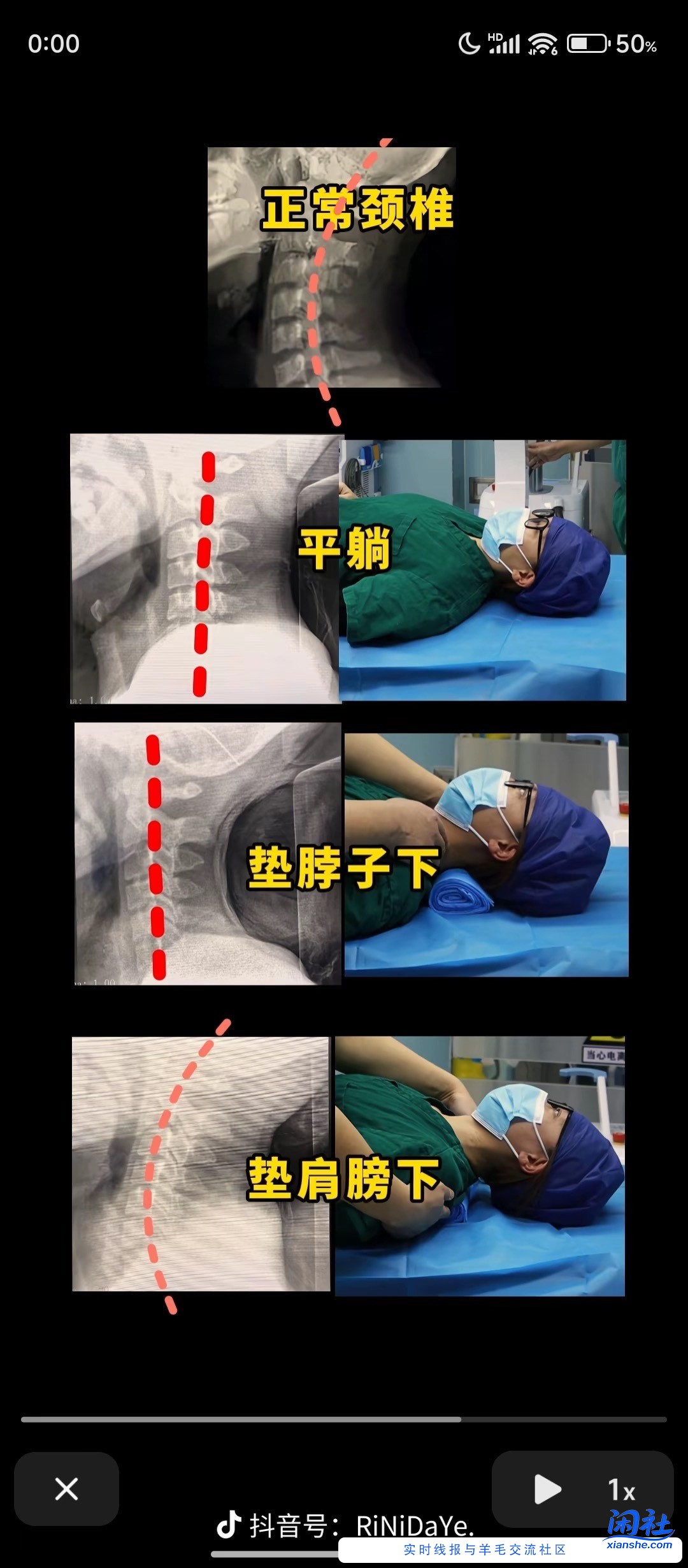 吧里有医生没，想问下生理曲线变直，轻微骨质增生可以在家用牵引器不