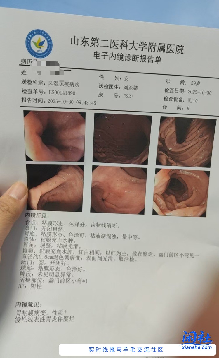 类风湿，干燥症，白内障，颈椎病，腰间盘突，脑供血不足，关节变形，今天喜提胃糜烂